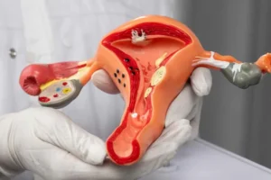 What is Vaginal Tightening Surgery?
