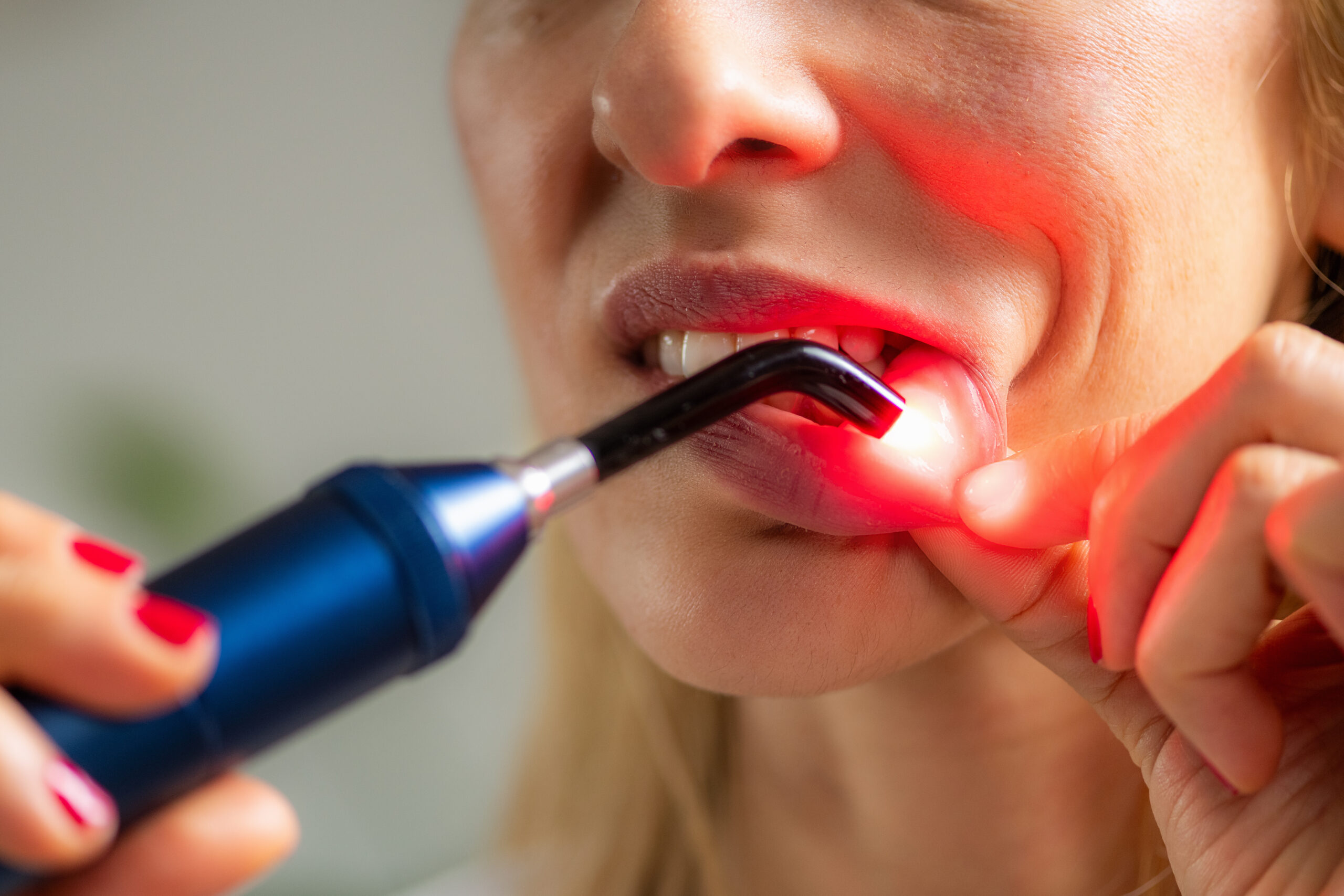 Ağız Kanseri: Belirtileri ve Tedavi Seçenekleri