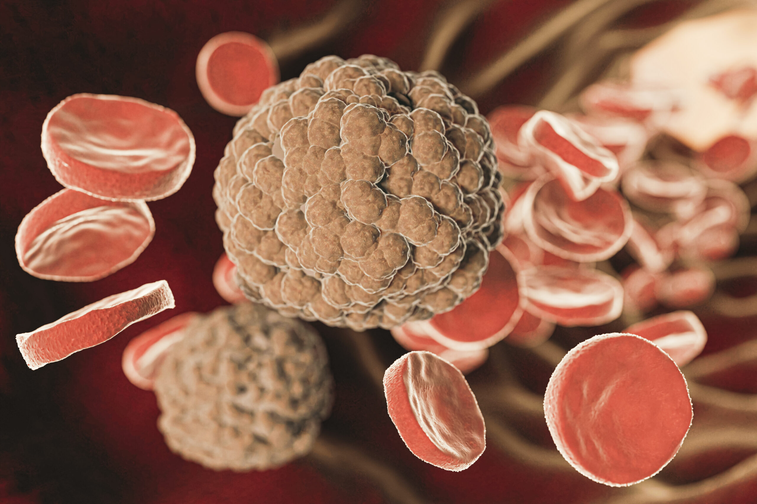 Aplastik Anemi Nedir? Belirtileri ve Tedavisi