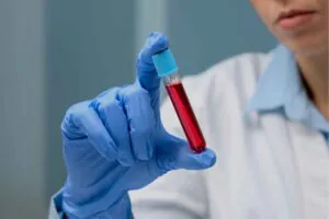 APTT Testi Nedir? aPTT Yüksekliği ve Düşüklüğü