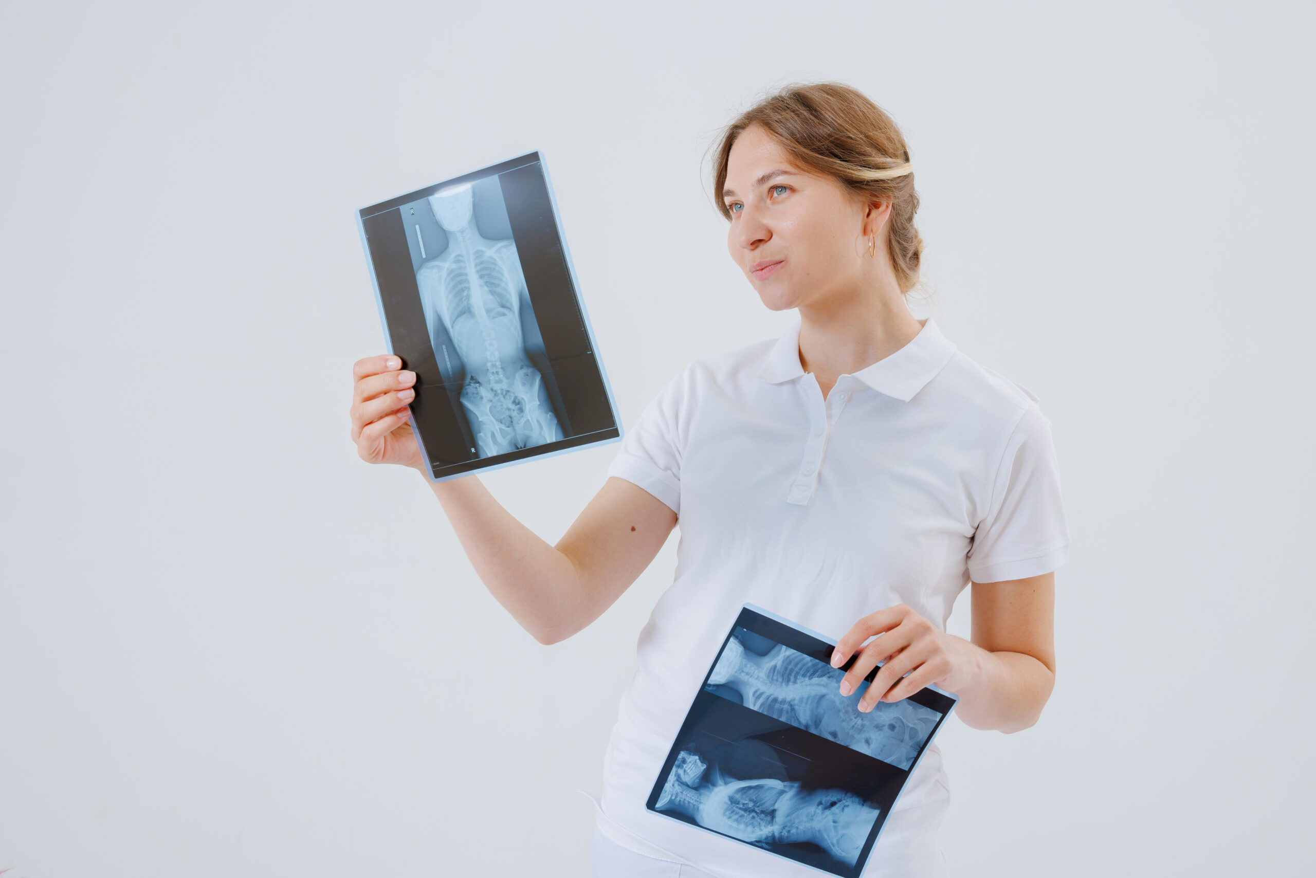 Cam Kemik Hastalığı (Osteogenesis Imperfekta)