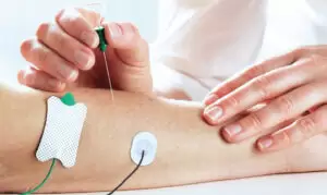 Elektromiyografi Nedir?