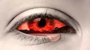 Gözyaşı Damar Tıkanıklığı