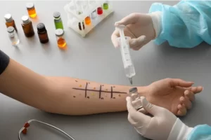 Alerji Deri Testi – Deri Prick Testi