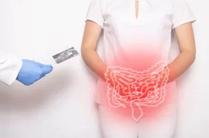 Crohn Hastalığı