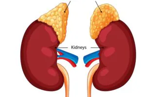 Addison Hastalığı (Adrenal Yetmezlik)