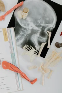 Kemik Yumuşaması (Osteomalazi)