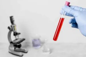 NRBC Nedir? Yüksekliği ve Düşüklüğü Ne Anlama Gelir?