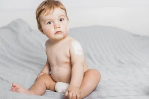 Bebek Aknesi (Sivilcesi) Nedir? Nasıl Başa Çıkılır?