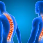 Sırt Fıtığı Nedir? Nedenleri, Belirtileri ve Tedavisi
