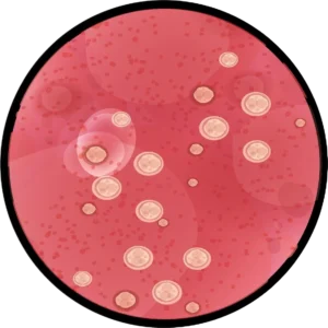 Bartholin Apsesi Ameliyatı