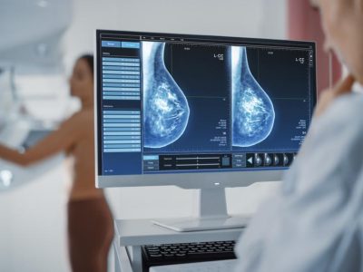 mamografi